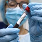 Coronavirus en Argentina | Reportaron 16 muertos y 774 contagios en las últimas 24 horas