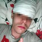 Herido tras recibir un piedrazo en la cabeza
